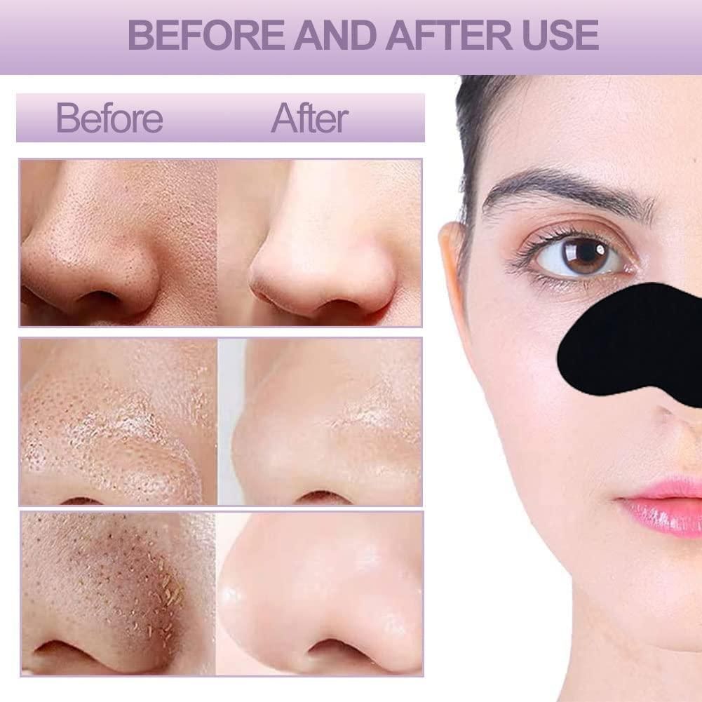 Deep Cleansing Blackhead Remover Strips