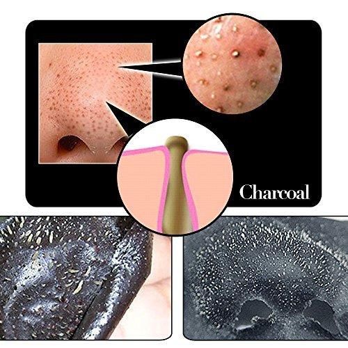 Deep Cleansing Blackhead Remover Strips