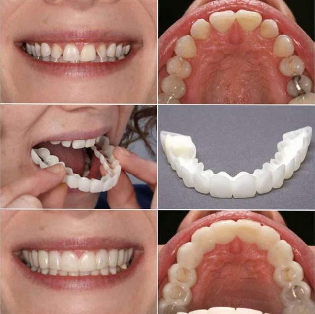 Perfect Smile Snap-On Veneers | Instant Teeth Whitening Cover | Natural Looking Cosmetic Dental Veneers