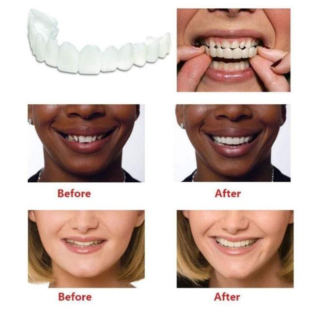 Perfect Smile Snap-On Veneers | Instant Teeth Whitening Cover | Natural Looking Cosmetic Dental Veneers