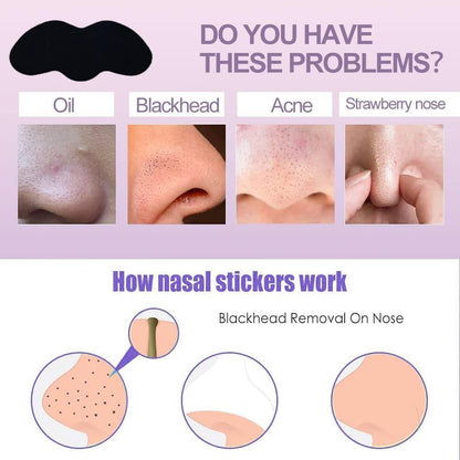 Deep Cleansing Blackhead Remover Strips