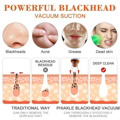 Vacuum Blackhead Remover Pro